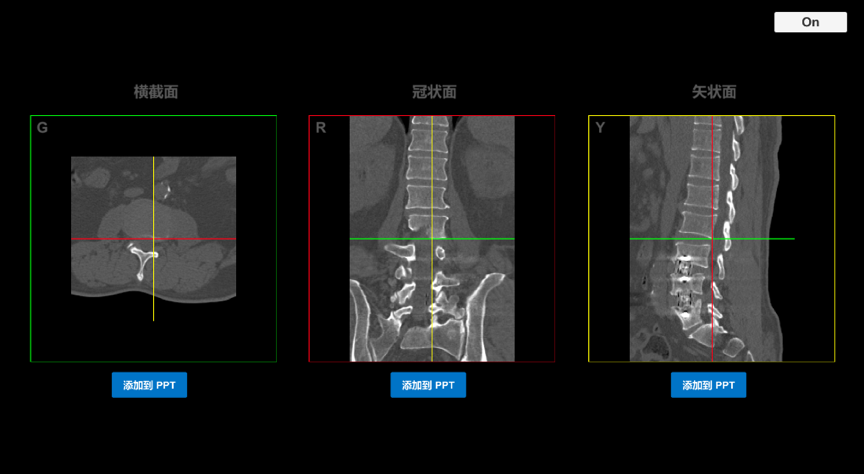 AI-Link專病數(shù)據(jù)庫(kù)標(biāo)注系統(tǒng)
