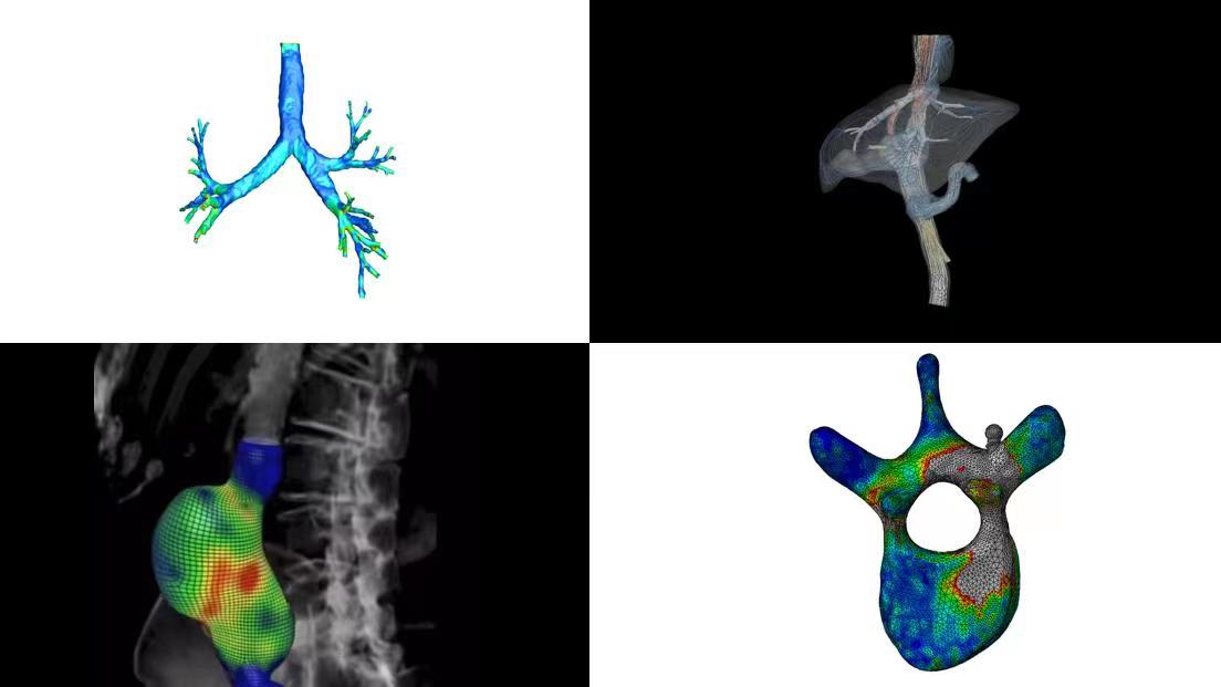 有限元分析平臺(tái)